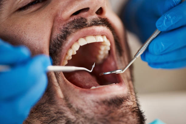 Tooth Infection Emergency Dentist in AR